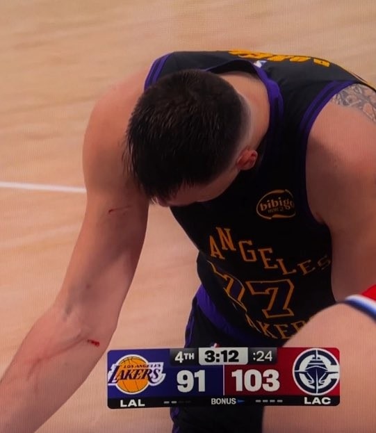 8868体育平台-谁抓的~东契奇罚球时看向手臂 好几道伤口&血迹斑斑